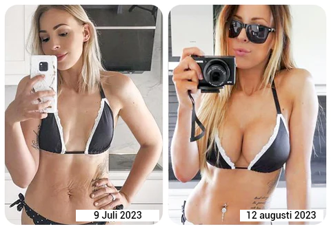 ¡Descubre ahora el aceite Lifting para levantamiento de espalda y senos!